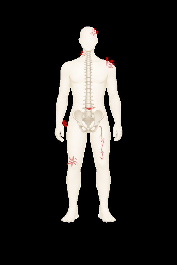 Schéma du corps avec zones de douleurs fréquentes
